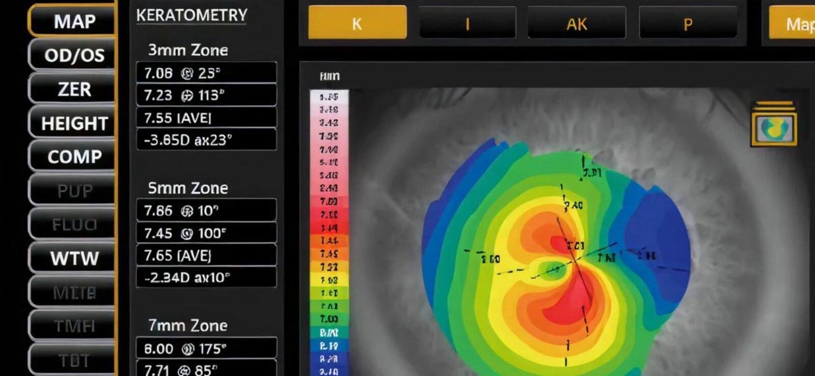 Topografska mapa rožnjače sa aparata Topcon MYAH